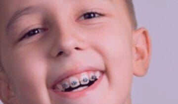 Children Orthodontics