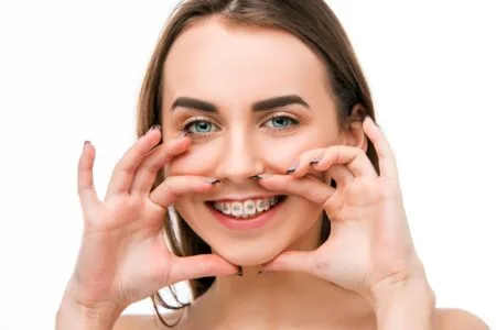 Conventional Metal Braces Al Ain