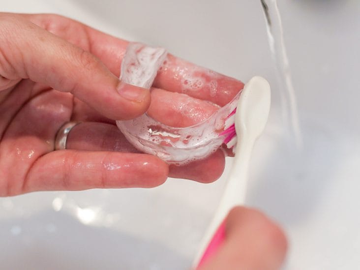 woman's hands washing her invisible aligners for dental correction with soap and water