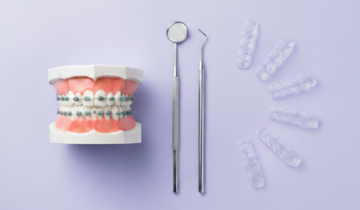 التقويم الشفاف أم المعدني في العين