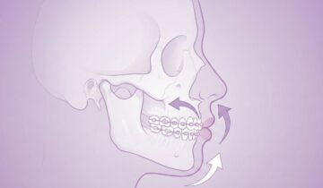 تقويم الأسنان وتجميل الوجه: هل يتغير شكل الأنف والذقن؟ (حقائق طبية)