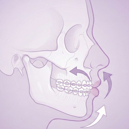 صورة قبل وبعد توضح تأثير تقويم الأسنان على تحسين بروفايل الوجه، الذقن، وتناسق الأنف والشفاه في عيادة الدكتور خالد الكاتب، الأمين العام لجمعية الإمارات لتقويم الأسنان.